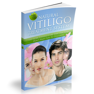 Natural Vitiligo Treatment System – E Book - Stop The Spreading of Your Vitiligo Immediately and Cure Your Vitiligo Completely and Permanently Within 2 Months! Includes 3 months of free private consultations with Michael Dawson.